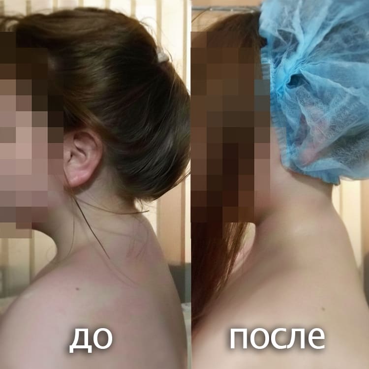 Избавление от боли в холке через массаж